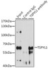 Immunoprecipitation analysis of 200ug extracts of HeLa cells, using 3 ug TSPYL1 antibody (14-295) . Western blot was performed from the immunoprecipitate using TSPYL1 antibody (14-295) at a dilition of 1:1000.