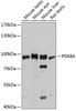 Western blot analysis of extracts of various cell lines, using PDE8A antibody (14-301) at 1:3000 dilution.<br/>Secondary antibody: HRP Goat Anti-Rabbit IgG (H+L) at 1:10000 dilution.<br/>Lysates/proteins: 25ug per lane.<br/>Blocking buffer: 3% nonfat dry milk in TBST.<br/>Detection: ECL Basic Kit.<br/>Exposure time: 5s.