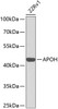 Western blot analysis of extracts of 22Rv1 cells, using APOH antibody (14-311) at 1:1000 dilution.<br/>Secondary antibody: HRP Goat Anti-Rabbit IgG (H+L) at 1:10000 dilution.<br/>Lysates/proteins: 25ug per lane.<br/>Blocking buffer: 3% nonfat dry milk in TBST.<br/>Detection: ECL Basic Kit.<br/>Exposure time: 30s.