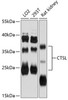 Western blot analysis of extracts of various cell lines, using CTSL antibody (14-312) at 1:3000 dilution.<br/>Secondary antibody: HRP Goat Anti-Rabbit IgG (H+L) at 1:10000 dilution.<br/>Lysates/proteins: 25ug per lane.<br/>Blocking buffer: 3% nonfat dry milk in TBST.<br/>Detection: ECL Basic Kit.<br/>Exposure time: 60s.