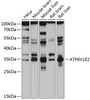 Western blot analysis of extracts of various cell lines, using ATP6V1E2 antibody (14-313) at 1:1000 dilution.<br/>Secondary antibody: HRP Goat Anti-Rabbit IgG (H+L) at 1:10000 dilution.<br/>Lysates/proteins: 25ug per lane.<br/>Blocking buffer: 3% nonfat dry milk in TBST.<br/>Detection: ECL Basic Kit.<br/>Exposure time: 60s.