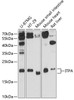 Western blot analysis of extracts of various cell lines, using ITPA antibody (14-317) at 1:3000 dilution.<br/>Secondary antibody: HRP Goat Anti-Rabbit IgG (H+L) at 1:10000 dilution.<br/>Lysates/proteins: 25ug per lane.<br/>Blocking buffer: 3% nonfat dry milk in TBST.<br/>Detection: ECL Enhanced Kit.<br/>Exposure time: 90s.