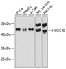 Western blot analysis of extracts of various cell lines, using HOXC10 antibody (14-319) at 1:1000 dilution.<br/>Secondary antibody: HRP Goat Anti-Rabbit IgG (H+L) at 1:10000 dilution.<br/>Lysates/proteins: 25ug per lane.<br/>Blocking buffer: 3% nonfat dry milk in TBST.<br/>Detection: ECL Basic Kit.<br/>Exposure time: 10s.