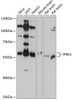Western blot analysis of extracts of various cell lines, using IP6K1 antibody (14-320) at 1:1000 dilution.<br/>Secondary antibody: HRP Goat Anti-Rabbit IgG (H+L) at 1:10000 dilution.<br/>Lysates/proteins: 25ug per lane.<br/>Blocking buffer: 3% nonfat dry milk in TBST.<br/>Detection: ECL Basic Kit.<br/>Exposure time: 10s.