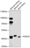 Western blot analysis of extracts of various cell lines, using PORCN antibody (14-334) at 1:3000 dilution.<br/>Secondary antibody: HRP Goat Anti-Rabbit IgG (H+L) at 1:10000 dilution.<br/>Lysates/proteins: 25ug per lane.<br/>Blocking buffer: 3% nonfat dry milk in TBST.<br/>Detection: ECL Enhanced Kit.<br/>Exposure time: 90s.