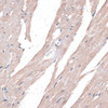 Immunohistochemistry of paraffin-embedded mouse heart using PPT2 antibody (14-335) at dilution of 1:100 (40x lens) .