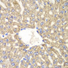 Immunohistochemistry of paraffin-embedded rat liver using ALDH2 antibody (14-336) at dilution of 1:100 (40x lens) .