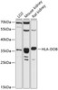 Western blot analysis of extracts of various cell lines, using HLA-DOB antibody (14-338) at 1:3000 dilution.<br/>Secondary antibody: HRP Goat Anti-Rabbit IgG (H+L) at 1:10000 dilution.<br/>Lysates/proteins: 25ug per lane.<br/>Blocking buffer: 3% nonfat dry milk in TBST.<br/>Detection: ECL Basic Kit.<br/>Exposure time: 90s.