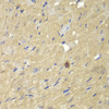 Immunohistochemistry of paraffin-embedded mouse heart using AKR7A2 antibody (14-342) at dilution of 1:100 (40x lens) .