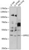 Western blot analysis of extracts of various cell lines, using GPR52 antibody (14-348) at 1:1000 dilution.<br/>Secondary antibody: HRP Goat Anti-Rabbit IgG (H+L) at 1:10000 dilution.<br/>Lysates/proteins: 25ug per lane.<br/>Blocking buffer: 3% nonfat dry milk in TBST.<br/>Detection: ECL Basic Kit.<br/>Exposure time: 10s.