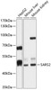 Western blot analysis of extracts of various cell lines, using SARS2 antibody (14-350) at 1:1000 dilution.<br/>Secondary antibody: HRP Goat Anti-Rabbit IgG (H+L) at 1:10000 dilution.<br/>Lysates/proteins: 25ug per lane.<br/>Blocking buffer: 3% nonfat dry milk in TBST.<br/>Detection: ECL Basic Kit.<br/>Exposure time: 10s.