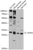 Western blot analysis of extracts of various cell lines, using SFXN3 antibody (14-351) at 1:1000 dilution.<br/>Secondary antibody: HRP Goat Anti-Rabbit IgG (H+L) at 1:10000 dilution.<br/>Lysates/proteins: 25ug per lane.<br/>Blocking buffer: 3% nonfat dry milk in TBST.<br/>Detection: ECL Basic Kit.<br/>Exposure time: 10s.