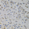 Immunohistochemistry of paraffin-embedded rat brain using SNAI1 antibody (14-354) (40x lens) .