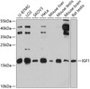 Western blot analysis of extracts of various cell lines, using IGF1 antibody (14-356) at 1:3000 dilution.<br/>Secondary antibody: HRP Goat Anti-Rabbit IgG (H+L) at 1:10000 dilution.<br/>Lysates/proteins: 25ug per lane.<br/>Blocking buffer: 3% nonfat dry milk in TBST.<br/>Detection: ECL Enhanced Kit.<br/>Exposure time: 30s.