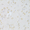 Immunohistochemistry of paraffin-embedded rat brain using NTS antibody (14-365) at dilution of 1:100 (40x lens) .