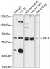 Western blot analysis of extracts of various cell lines, using PKLR antibody (14-367) at 1:3000 dilution.<br/>Secondary antibody: HRP Goat Anti-Rabbit IgG (H+L) at 1:10000 dilution.<br/>Lysates/proteins: 25ug per lane.<br/>Blocking buffer: 3% nonfat dry milk in TBST.<br/>Detection: ECL Basic Kit.<br/>Exposure time: 90s.