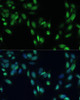 Immunofluorescence analysis of U2OS cells using SMAD7 antibody (14-369) at dilution of 1:100. Blue: DAPI for nuclear staining.