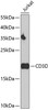 Western blot analysis of extracts of Jurkat cells, using CD3D antibody (14-385) at 1:500 dilution._Secondary antibody: HRP Goat Anti-Rabbit IgG (H+L) at 1:10000 dilution._Lysates/proteins: 25ug per lane._Blocking buffer: 3% nonfat dry milk in TBST._Detection: ECL Enhanced Kit._Exposure time: 90s.