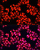Immunofluorescence analysis of HeLa cells using ALAD antibody (14-396) at dilution of 1:100. Blue: DAPI for nuclear staining.