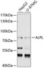 Western blot analysis of extracts of various cell lines, using ALPL antibody (14-397) at 1:1000 dilution.<br/>Secondary antibody: HRP Goat Anti-Rabbit IgG (H+L) at 1:10000 dilution.<br/>Lysates/proteins: 25ug per lane.<br/>Blocking buffer: 3% nonfat dry milk in TBST.<br/>Detection: ECL Basic Kit.<br/>Exposure time: 30s.