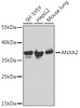 Western blot analysis of extracts of various cell lines, using ANXA2 Antibody (14-398) at 1:1000 dilution.<br/>Secondary antibody: HRP Goat Anti-Rabbit IgG (H+L) at 1:10000 dilution.<br/>Lysates/proteins: 25ug per lane.<br/>Blocking buffer: 3% nonfat dry milk in TBST.