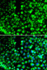 Immunofluorescence analysis of HeLa cells using CALU antibody (14-405) . Blue: DAPI for nuclear staining.