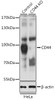 Western blot analysis of extracts from normal (control) and CD44 knockout (KO) HeLa cells, using CD44 antibody (14-407) at 1:1000 dilution.<br/>Secondary antibody: HRP Goat Anti-Rabbit IgG (H+L) at 1:10000 dilution.<br/>Lysates/proteins: 25ug per lane.<br/>Blocking buffer: 3% nonfat dry milk in TBST.<br/>Detection: ECL Basic Kit.<br/>Exposure time: 5s.