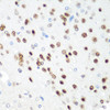 Immunohistochemistry of paraffin-embedded rat brain using CDK1 antibody (14-408) at dilution of 1:100 (40x lens) .