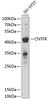 Western blot analysis of extracts of SH-SY5Y cells, using CNTFR antibody (14-414) at 1:1000 dilution.<br/>Secondary antibody: HRP Goat Anti-Rabbit IgG (H+L) at 1:10000 dilution.<br/>Lysates/proteins: 25ug per lane.<br/>Blocking buffer: 3% nonfat dry milk in TBST.<br/>Detection: ECL Basic Kit.<br/>Exposure time: 3s.