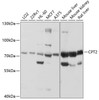 Western blot analysis of extracts of various cell lines, using CPT2 antibody (14-415) at 1:1000 dilution.<br/>Secondary antibody: HRP Goat Anti-Rabbit IgG (H+L) at 1:10000 dilution.<br/>Lysates/proteins: 25ug per lane.<br/>Blocking buffer: 3% nonfat dry milk in TBST.<br/>Detection: ECL Basic Kit.<br/>Exposure time: 1s.