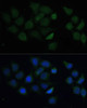 Immunofluorescence analysis of HeLa cells using CPT2 antibody (14-415) at dilution of 1:100. Blue: DAPI for nuclear staining.