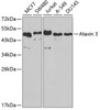 Western blot analysis of extracts of various cell lines, using Ataxin 3 antibody (14-418) at 1:1000 dilution.<br/>Secondary antibody: HRP Goat Anti-Rabbit IgG (H+L) at 1:10000 dilution.<br/>Lysates/proteins: 25ug per lane.<br/>Blocking buffer: 3% nonfat dry milk in TBST.