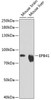 Western blot analysis of extracts of various cell lines, using EPB41 Antibody (14-420) at 1:1000 dilution.<br/>Secondary antibody: HRP Goat Anti-Rabbit IgG (H+L) at 1:10000 dilution.<br/>Lysates/proteins: 25ug per lane.<br/>Blocking buffer: 3% nonfat dry milk in TBST.<br/>Detection: ECL Enhanced Kit.