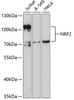 Western blot analysis of extracts of various cell lines, using NRF2 antibody (14-423) at 1:1000 dilution.<br/>Secondary antibody: HRP Goat Anti-Rabbit IgG (H+L) at 1:10000 dilution.<br/>Lysates/proteins: 25ug per lane.<br/>Blocking buffer: 3% nonfat dry milk in TBST.<br/>Detection: ECL Enhanced Kit.<br/>Exposure time: 90s.
