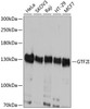 Western blot analysis of extracts of various cell lines, using GTF2I antibody (14-424) at 1:1000 dilution.<br/>Secondary antibody: HRP Goat Anti-Rabbit IgG (H+L) at 1:10000 dilution.<br/>Lysates/proteins: 25ug per lane.<br/>Blocking buffer: 3% nonfat dry milk in TBST.<br/>Detection: ECL Basic Kit.<br/>Exposure time: 1s.