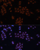 Immunofluorescence analysis of HeLa cells using GTF2I antibody (14-424) at dilution of 1:100. Blue: DAPI for nuclear staining.