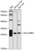 Western blot analysis of extracts of various cell lines, using HLA-DRB3 antibody (14-426) at 1:1000 dilution.<br/>Secondary antibody: HRP Goat Anti-Rabbit IgG (H+L) at 1:10000 dilution.<br/>Lysates/proteins: 25ug per lane.<br/>Blocking buffer: 3% nonfat dry milk in TBST.<br/>Detection: ECL Basic Kit.<br/>Exposure time: 30s.