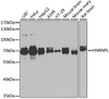Western blot analysis of extracts of various cell lines, using HNRNPL antibody (14-428) at 1:1000 dilution.<br/>Secondary antibody: HRP Goat Anti-Rabbit IgG (H+L) at 1:10000 dilution.<br/>Lysates/proteins: 25ug per lane.<br/>Blocking buffer: 3% nonfat dry milk in TBST.<br/>Detection: ECL Basic Kit.<br/>Exposure time: 90s.