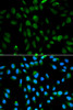 Immunofluorescence analysis of MCF-7 cells using PSMA3 antibody (14-431) . Blue: DAPI for nuclear staining.