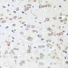 Immunohistochemistry of paraffin-embedded mouse brain using IGFBP5 antibody (14-433) at dilution of 1:100 (40x lens) .