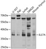 Western blot analysis of extracts of various cell lines, using IL17A antibody (14-434) at 1:1000 dilution.<br/>Secondary antibody: HRP Goat Anti-Rabbit IgG (H+L) at 1:10000 dilution.<br/>Lysates/proteins: 25ug per lane.<br/>Blocking buffer: 3% nonfat dry milk in TBST.<br/>Detection: ECL Enhanced Kit.<br/>Exposure time: 30s.