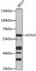 Western blot analysis of extracts of MCF7 cells, using KCNJ3 antibody (14-435) at 1:1000 dilution.<br/>Secondary antibody: HRP Goat Anti-Rabbit IgG (H+L) at 1:10000 dilution.<br/>Lysates/proteins: 25ug per lane.<br/>Blocking buffer: 3% nonfat dry milk in TBST.<br/>Detection: ECL Basic Kit.<br/>Exposure time: 20s.