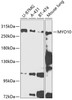Western blot analysis of extracts of various cell lines, using MYO10 antibody (14-439) at 1:1000 dilution.<br/>Secondary antibody: HRP Goat Anti-Rabbit IgG (H+L) at 1:10000 dilution.<br/>Lysates/proteins: 25ug per lane.<br/>Blocking buffer: 3% nonfat dry milk in TBST.<br/>Detection: ECL Enhanced Kit.<br/>Exposure time: 90s.
