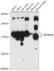 Western blot analysis of extracts of various cell lines, using EIF4EBP1 antibody (14-450) at 1:1000 dilution.<br/>Secondary antibody: HRP Goat Anti-Rabbit IgG (H+L) at 1:10000 dilution.<br/>Lysates/proteins: 25ug per lane.<br/>Blocking buffer: 3% nonfat dry milk in TBST.<br/>Detection: ECL Basic Kit.<br/>Exposure time: 60s.
