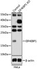 Western blot analysis of extracts from normal (control) and EIF4EBP1 knockout (KO) HeLa cells, using EIF4EBP1 antibody (14-450) at 1:500 dilution.<br/>Secondary antibody: HRP Goat Anti-Rabbit IgG (H+L) at 1:10000 dilution.<br/>Lysates/proteins: 25ug per lane.<br/>Blocking buffer: 3% nonfat dry milk in TBST.<br/>Detection: ECL Basic Kit.<br/>Exposure time: 30s.