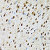 Immunohistochemistry of paraffin-embedded rat brain using PSMD13 antibody (14-453) at dilution of 1:100 (40x lens) .