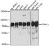 Western blot analysis of extracts of various cell lines, using PTPN11 antibody (14-454) at 1:1000 dilution.<br/>Secondary antibody: HRP Goat Anti-Rabbit IgG (H+L) at 1:10000 dilution.<br/>Lysates/proteins: 25ug per lane.<br/>Blocking buffer: 3% nonfat dry milk in TBST.<br/>Detection: ECL Basic Kit.<br/>Exposure time: 3s.