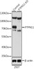 Immunofluorescence analysis of C6 cells using PTPN11 antibody (14-454) at dilution of 1:100. Blue: DAPI for nuclear staining.