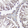 Immunohistochemistry of paraffin-embedded rat testis using VAMP2 antibody (14-457) at dilution of 1:100 (40x lens) .