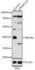 Western blot analysis of extracts from normal (control) and PRKAB1 knockout (KO) HeLa cells, using PRKAB1 antibody (14-458) at 1:1000 dilution.<br/>Secondary antibody: HRP Goat Anti-Rabbit IgG (H+L) at 1:10000 dilution.<br/>Lysates/proteins: 25ug per lane.<br/>Blocking buffer: 3% nonfat dry milk in TBST.<br/>Detection: ECL Basic Kit.<br/>Exposure time: 5s.